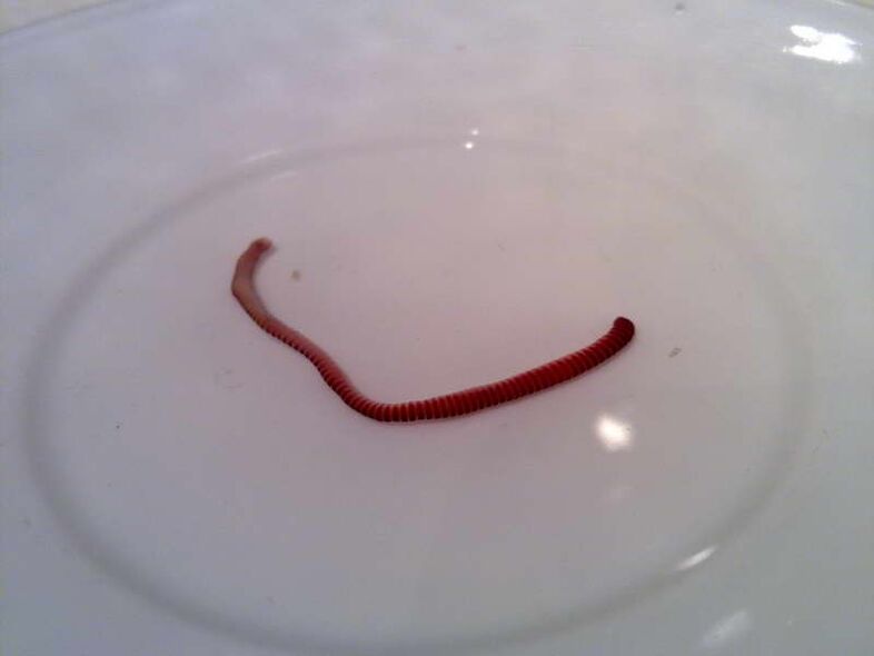 parasites from the human body