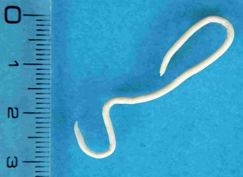worms from the human body