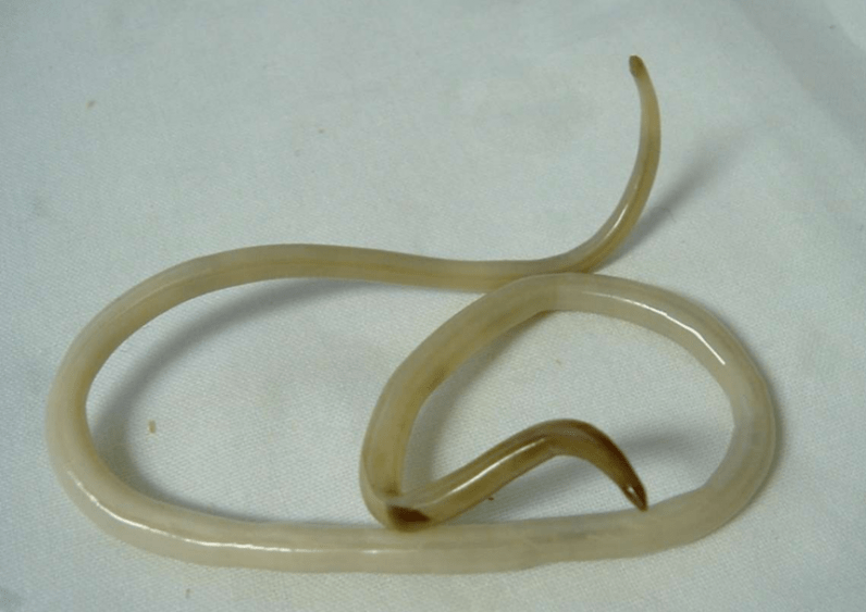 worms from the human body and their treatment
